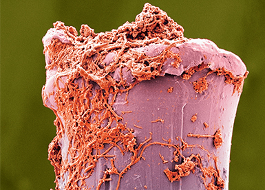 Magnified toothbrush bristle